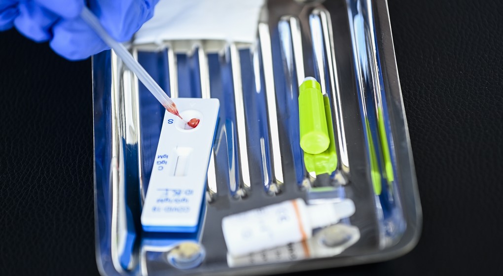 Test sérologique Coronavirus Covid-19 - Belga Laurie Dieffembacq