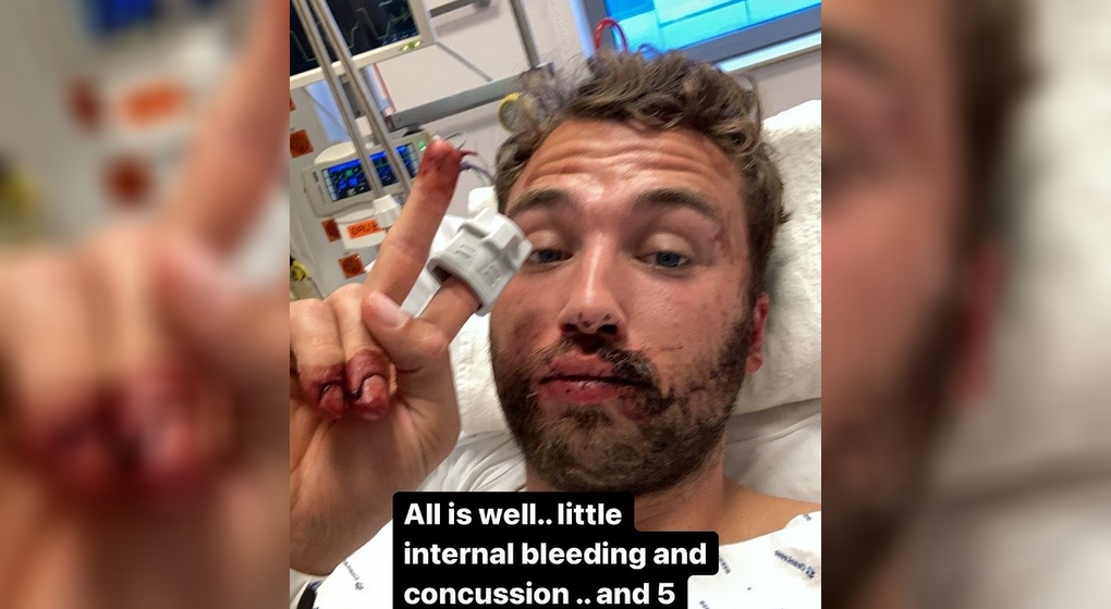 Emmanuel Stockbroekx Blessé Commotion - Instagram