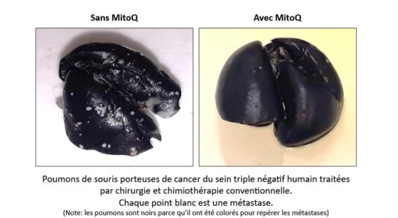 Cancer du Sein MitoQ Recherche UCLouvain
