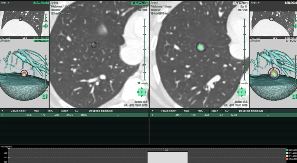 SYNAPSE 30 - clinique Saint Jean